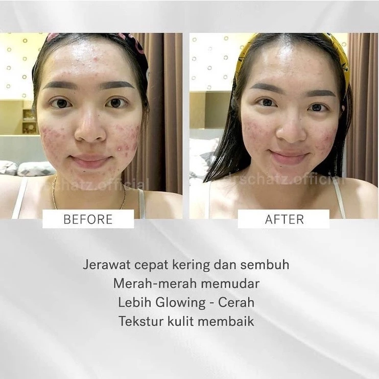 Dr. Schatz EGF Serum 7