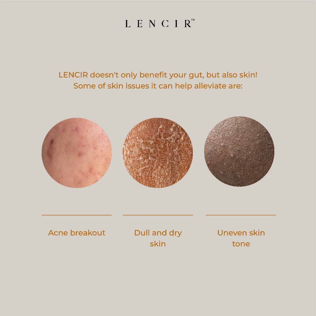 Lencir Original 8